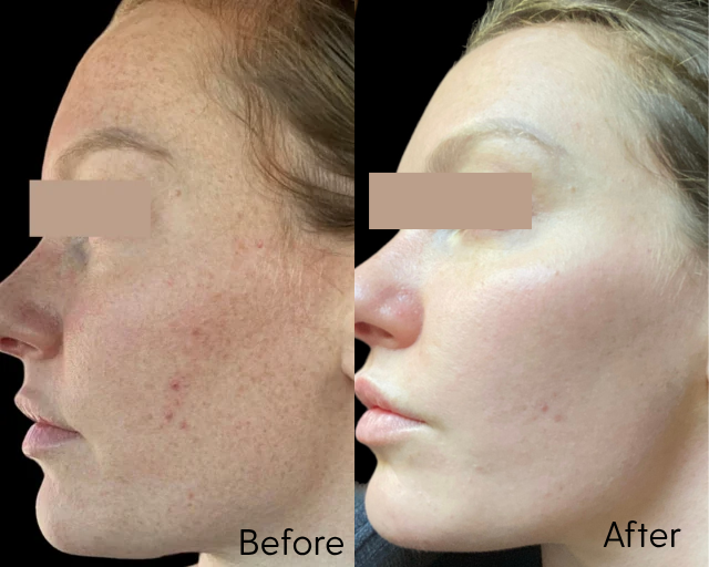 CO2 Full Face